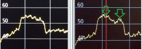 65° comparison. A-B ..GIF