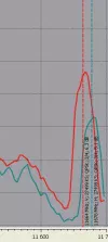 25,5E-scan.webp