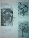 4 (Custom).webp